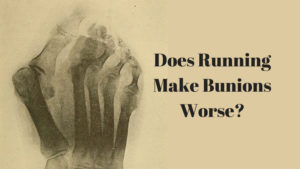 Does Running Make Bunions Worse